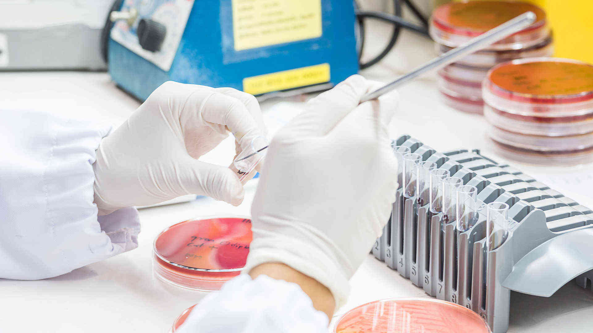 Antimicrobial Resistance Solutions & AMR Testing - Creative Diagnostics