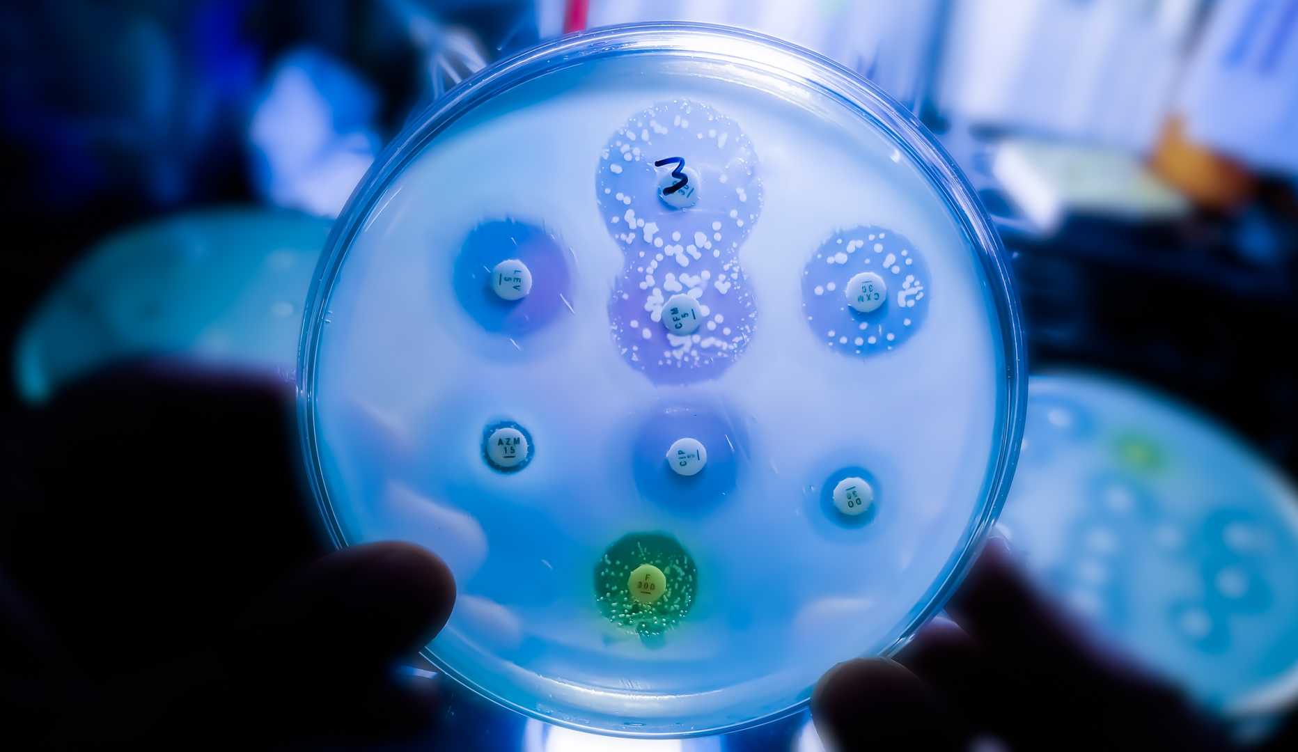 Antimicrobial Testing Services - Creative Diagnostics